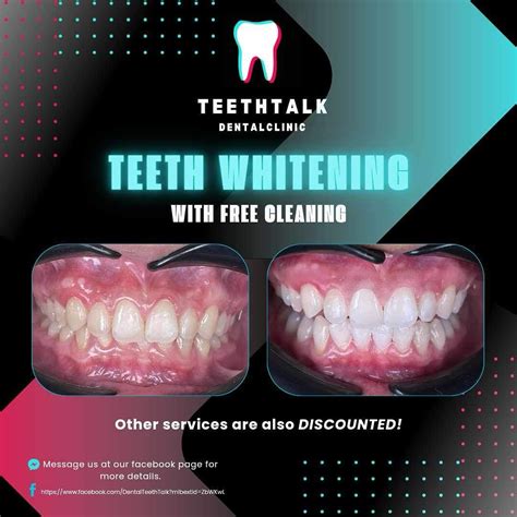 TeethTalk Dental Clinic (@dentalteethtalk) • Instagram photos .